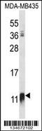 NADH:Ubiquinone Oxidoreductase Subunit AB1 antibody, 57-505, ProSci, Western Blot image 