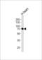 Caseinolytic Mitochondrial Matrix Peptidase Chaperone Subunit antibody, 55-403, ProSci, Western Blot image 