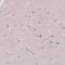ADP-Ribosylhydrolase Like 1 antibody, NBP2-39073, Novus Biologicals, Immunohistochemistry frozen image 