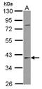 Serpin Family B Member 7 antibody, NBP2-20313, Novus Biologicals, Western Blot image 