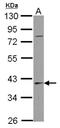 SERPINB7 antibody, NBP2-20313, Novus Biologicals, Western Blot image 