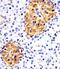 RAB3B, Member RAS Oncogene Family antibody, M09431, Boster Biological Technology, Immunohistochemistry paraffin image 