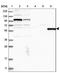 MSL Complex Subunit 3 antibody, NBP1-87881, Novus Biologicals, Western Blot image 