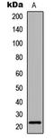 Claudin 6 antibody, LS-C354621, Lifespan Biosciences, Western Blot image 