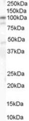 Catenin Alpha 1 antibody, MBS421290, MyBioSource, Western Blot image 