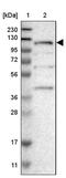 Coiled-Coil Domain Containing 186 antibody, PA5-53704, Invitrogen Antibodies, Western Blot image 