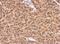 Protein Kinase C Substrate 80K-H antibody, NBP2-19931, Novus Biologicals, Immunohistochemistry paraffin image 