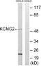Potassium Voltage-Gated Channel Modifier Subfamily G Member 2 antibody, GTX87981, GeneTex, Western Blot image 
