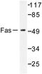 FAS antibody, LS-C176337, Lifespan Biosciences, Western Blot image 