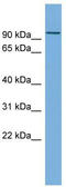 Multiple EGF Like Domains 11 antibody, TA339612, Origene, Western Blot image 