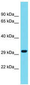 Meteorin Like, Glial Cell Differentiation Regulator antibody, TA334847, Origene, Western Blot image 
