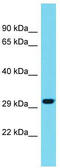 Meteorin Like, Glial Cell Differentiation Regulator antibody, TA334847, Origene, Western Blot image 