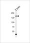 Adhesion G Protein-Coupled Receptor G6 antibody, PA5-72210, Invitrogen Antibodies, Western Blot image 