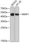 Matrix Metallopeptidase 1 antibody, 14-183, ProSci, Western Blot image 