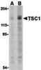 TSC Complex Subunit 1 antibody, LS-B1431, Lifespan Biosciences, Western Blot image 
