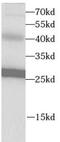 VAMP Associated Protein B And C antibody, FNab09370, FineTest, Western Blot image 