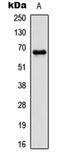 P21 (RAC1) Activated Kinase 1 antibody, abx121455, Abbexa, Western Blot image 