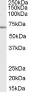 Amyloid Beta Precursor Protein Binding Family A Member 1 antibody, 45-260, ProSci, Western Blot image 