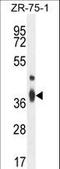 Transmembrane BAX Inhibitor Motif Containing 4 antibody, LS-C161945, Lifespan Biosciences, Western Blot image 