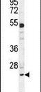 BAF Chromatin Remodeling Complex Subunit BCL7A antibody, PA5-24464, Invitrogen Antibodies, Western Blot image 