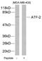 Activating Transcription Factor 2 antibody, 79-280, ProSci, Western Blot image 