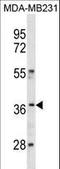 Homeobox C10 antibody, LS-C157815, Lifespan Biosciences, Western Blot image 