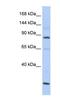MutS Homolog 5 antibody, NBP1-58158, Novus Biologicals, Western Blot image 