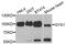 Glycogen Synthase 1 antibody, A2519, ABclonal Technology, Western Blot image 