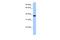 Actin Related Protein T2 antibody, A17262, Boster Biological Technology, Western Blot image 