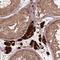 BRISC And BRCA1 A Complex Member 1 antibody, NBP2-49568, Novus Biologicals, Immunohistochemistry paraffin image 