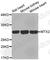 Metaxin 2 antibody, A3210, ABclonal Technology, Western Blot image 