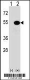 MAPK Activated Protein Kinase 5 antibody, 62-736, ProSci, Western Blot image 