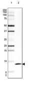 Immediate Early Response 3 Interacting Protein 1 antibody, PA5-52687, Invitrogen Antibodies, Western Blot image 