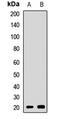 Cysteine And Glycine Rich Protein 3 antibody, LS-C667885, Lifespan Biosciences, Western Blot image 