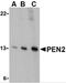 Presenilin Enhancer, Gamma-Secretase Subunit antibody, 3979, ProSci, Western Blot image 