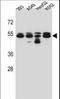 Tubulin Beta 8 Class VIII antibody, LS-C160336, Lifespan Biosciences, Western Blot image 