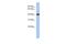 Zinc Finger FYVE-Type Containing 1 antibody, A10083, Boster Biological Technology, Western Blot image 