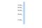 G2/M-Phase Specific E3 Ubiquitin Protein Ligase antibody, PA5-69221, Invitrogen Antibodies, Western Blot image 