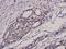 NFKB Inhibitor Alpha antibody, A01139S32S36, Boster Biological Technology, Immunohistochemistry paraffin image 
