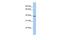 Serine Protease 54 antibody, GTX45399, GeneTex, Western Blot image 