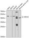 Eukaryotic Translation Initiation Factor 2 Subunit Beta antibody, 19-928, ProSci, Western Blot image 