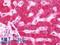 Inhibitor Of Nuclear Factor Kappa B Kinase Subunit Epsilon antibody, LS-B10817, Lifespan Biosciences, Immunohistochemistry paraffin image 