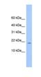 MORN Repeat Containing 4 antibody, orb325857, Biorbyt, Western Blot image 