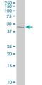 Signal Transducing Adaptor Molecule 2 antibody, H00010254-M01, Novus Biologicals, Western Blot image 