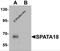 Spermatogenesis Associated 18 antibody, 6615, ProSci, Western Blot image 