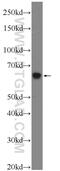 Hyaluronidase 4 antibody, 18139-1-AP, Proteintech Group, Western Blot image 