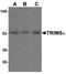 Tripartite Motif Containing 5 antibody, NBP1-77207, Novus Biologicals, Western Blot image 