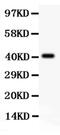 Synaptonemal Complex Protein 3 antibody, PA5-80086, Invitrogen Antibodies, Western Blot image 