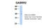 Gamma-Aminobutyric Acid Type A Receptor Rho2 Subunit antibody, ARP35060_P050, Aviva Systems Biology, Western Blot image 