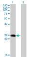 Bridging Integrator 3 antibody, LS-C139194, Lifespan Biosciences, Western Blot image 